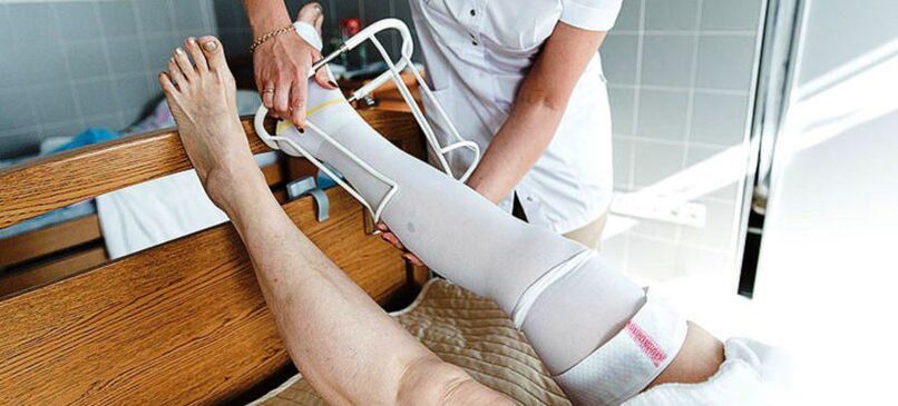 Medias de compresión para el tratamiento de las varices.